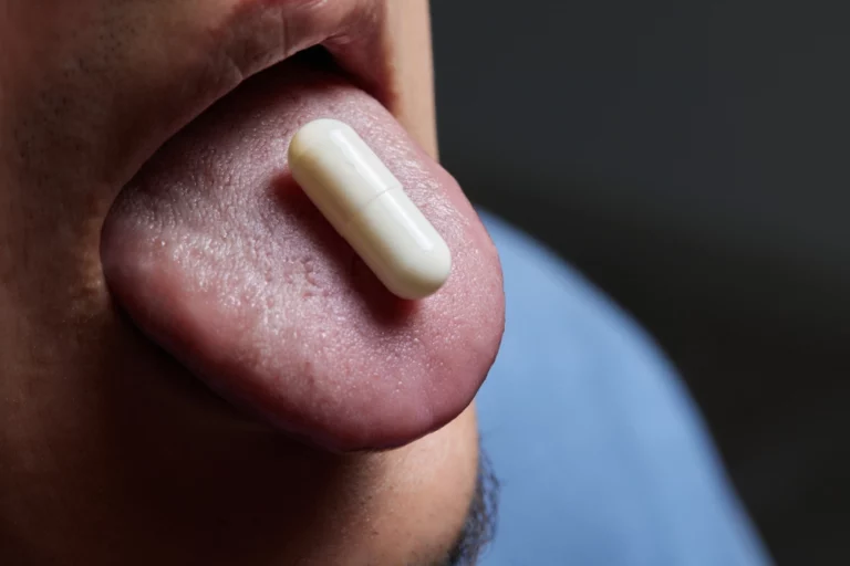 Adderall Tongue: What is it and How to Get Rid of it