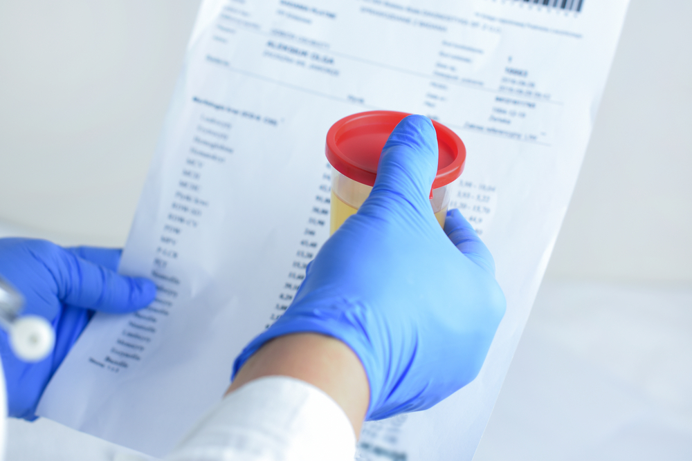 What is the best defense for a positive drug test