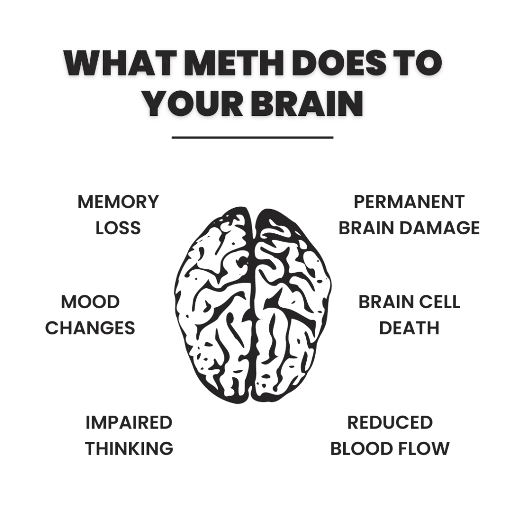 What Meth Does To Your Brain