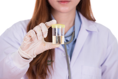 woman holding up a urine drug test vial